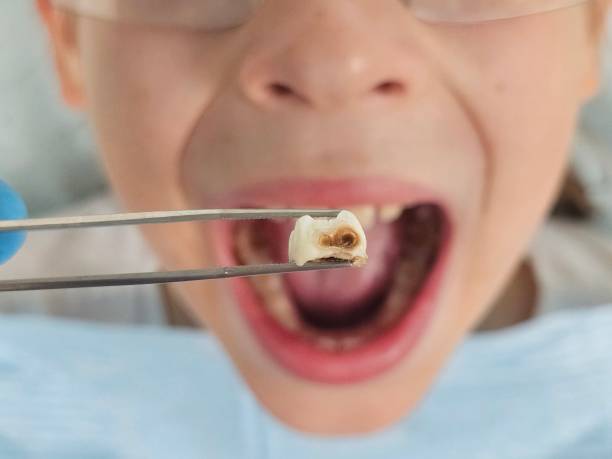 Best Emergency Dental Surgery in Simpsonville, KY